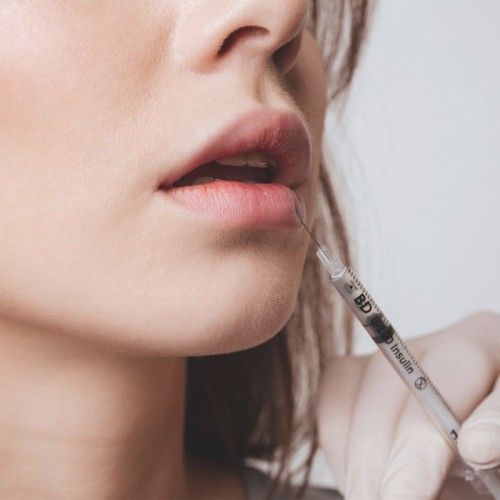 dermal fillers